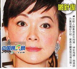 羊胎素明星,揭秘明星逆龄的秘密武器