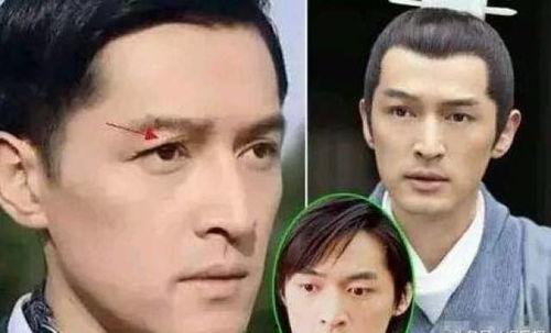 嗓子受伤的明星,演艺生涯的挑战与坚持